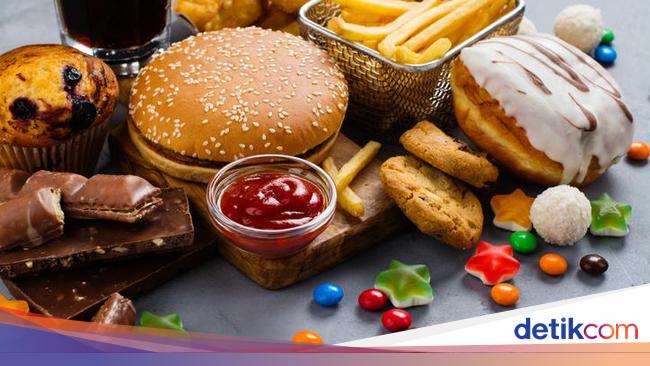 Hati-hati! Konsumsi 6 Makanan Ini Bisa Memicu Batu Empedu