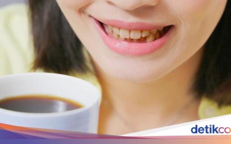 Ikuti 5 Cara Ini untuk Hilangkan Noda Kopi di Gigi